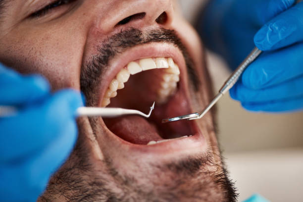 Best Urgent Tooth Repair  in Calcutta, OH